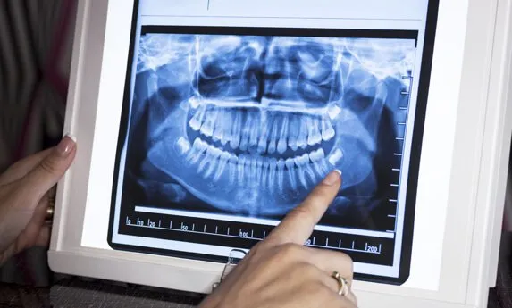 dentist-sheboygan-candited-img