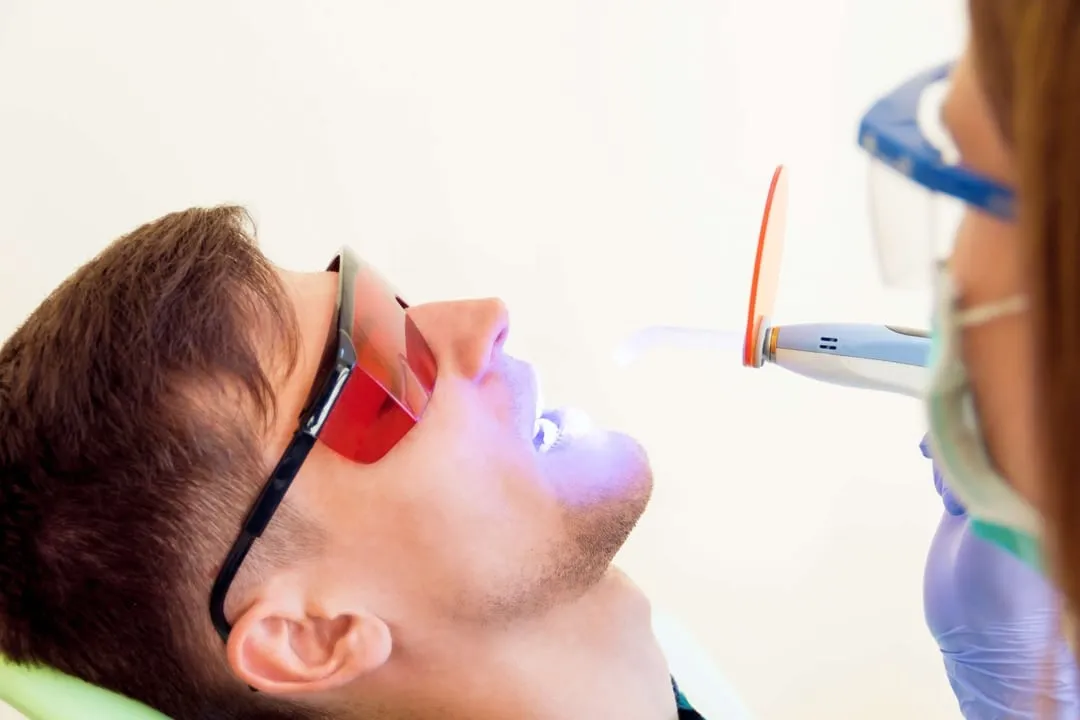 Sealants